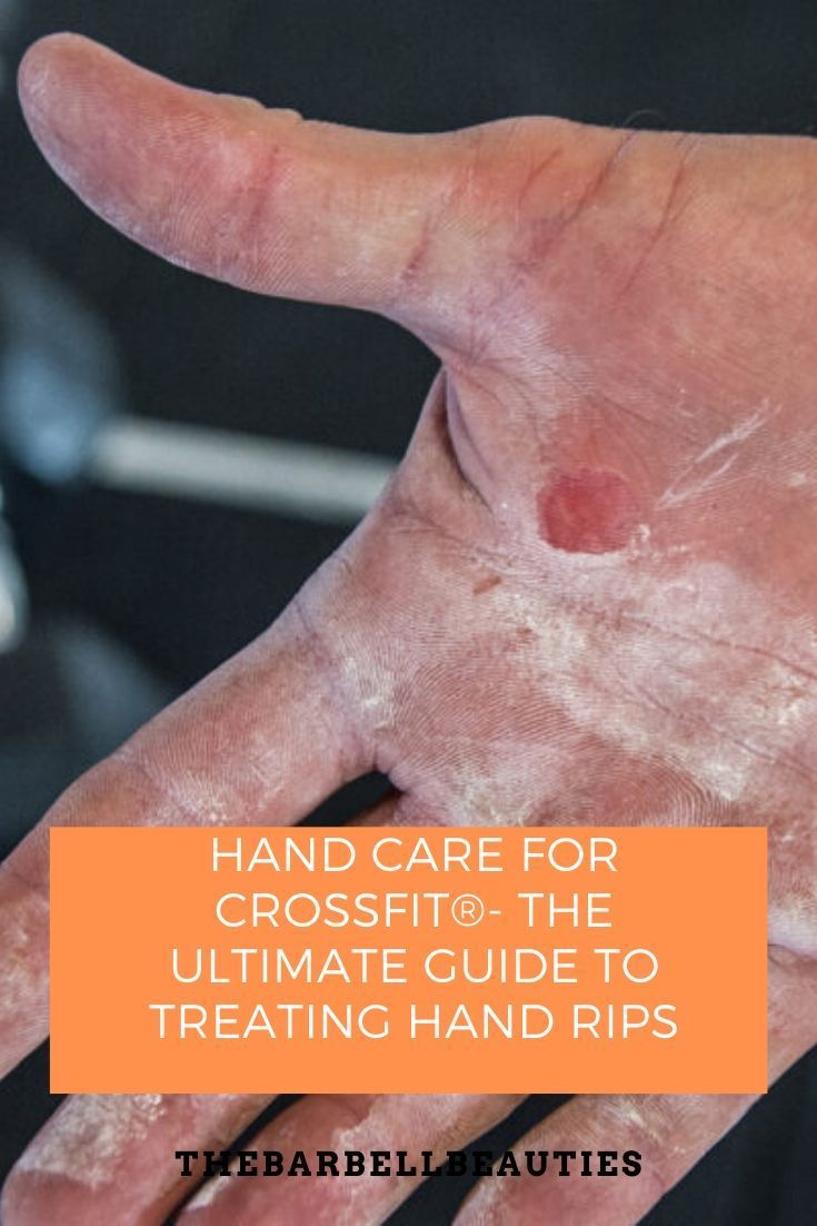 hand care for crossfit the ultimate guide to treating hand rips