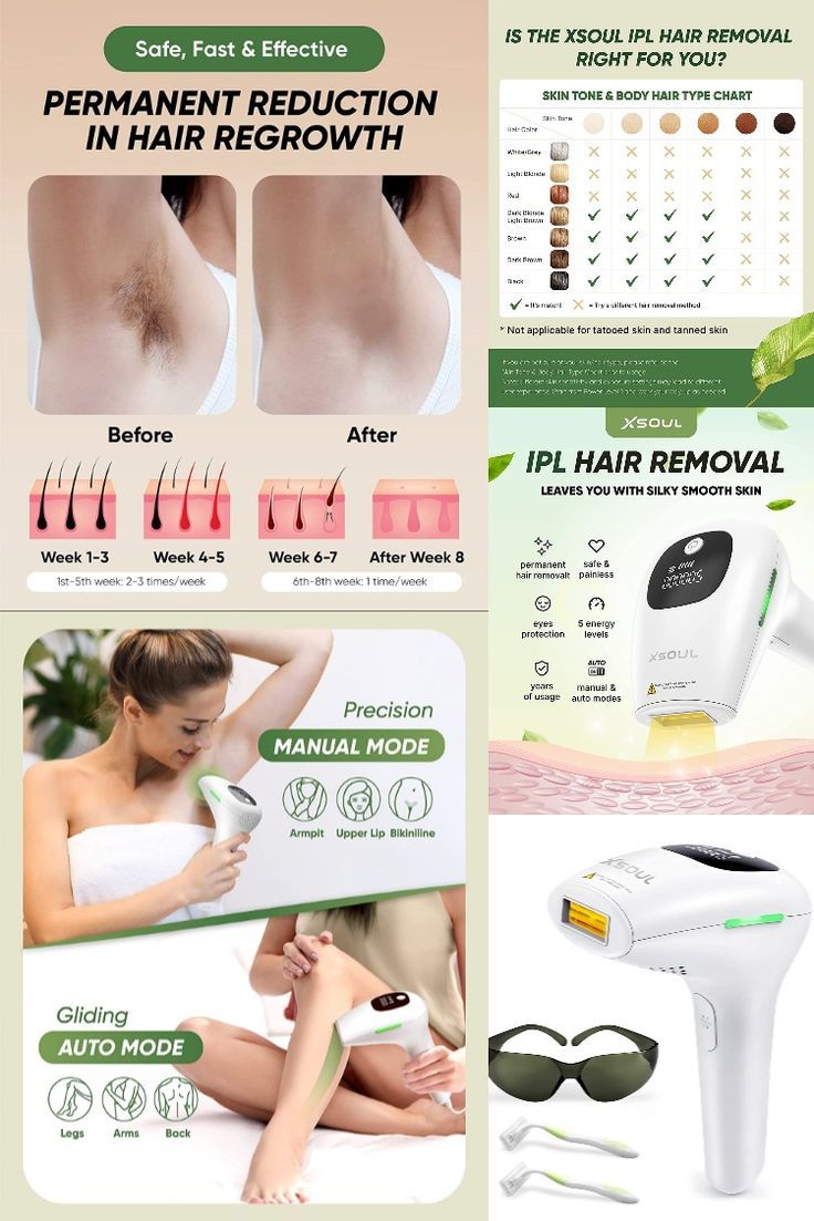 Waxing Vs Shaving, Hair Type Chart, Natural Hair Removal Remedies, Best Permanent Hair Removal, Permanent Hair Removal Cream, Permanent Facial Hair Removal, Lip Hair Removal, Face Hair Removal, Korean Beauty Tips