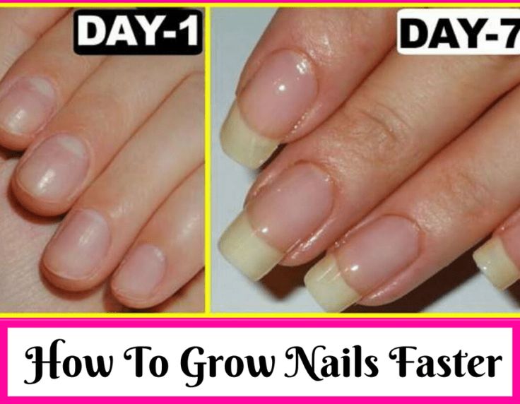 Nail Growth Faster, Make Nails Grow, Almond Blue Nails, White Toes Nail, Jumper Nails, Grow Long Nails, Nail Growth Tips, Grow Nails Faster, Flame Nails