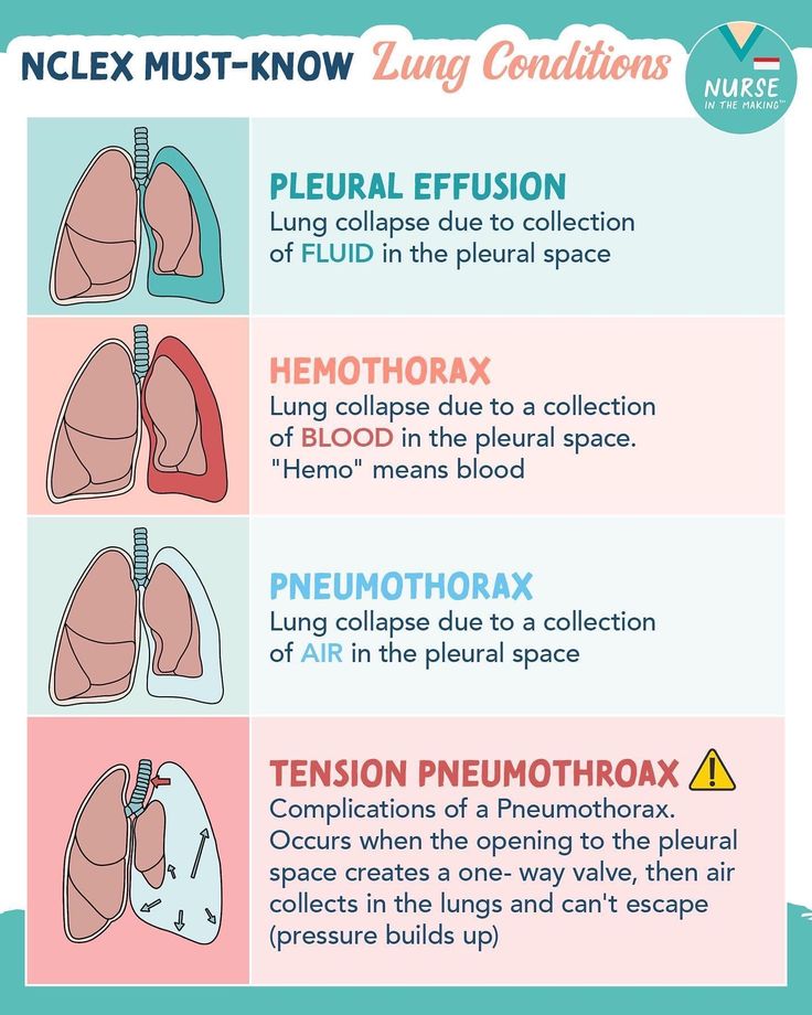 an info sheet describing the different types of lungs and how they are used to treat them