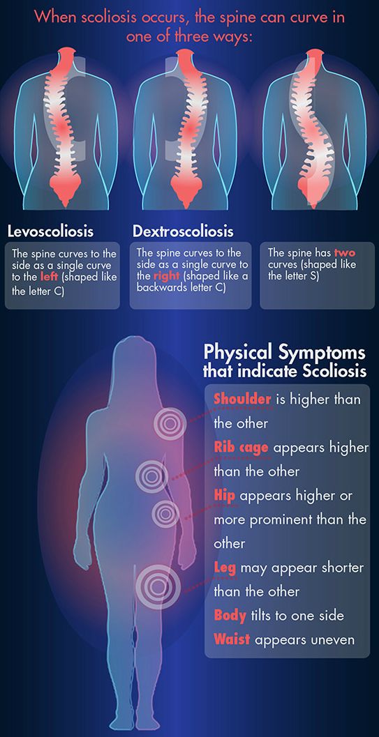 Curvature Of The Spine, Punkty Spustowe, Severe Back Pain, Spine Health, Lower Back Exercises, Medical Anatomy, Chiropractic Care, Medical Knowledge, Hip Pain