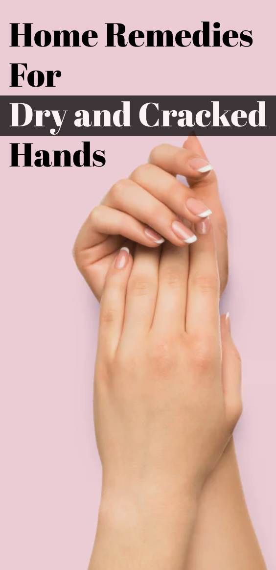 Home Remedies For Severely Dry and Cracked Hands| Dry Hands Remedy Homemade How To Get Rid Of Dry Hands, Soft Hands Remedy, Dry Cracked Hands Remedy, Cracked Hands Remedy, Chapped Hands Remedy, Hand Remedies, Dry Hands Remedy, Dry Skin Diy, Dry Hand Skin