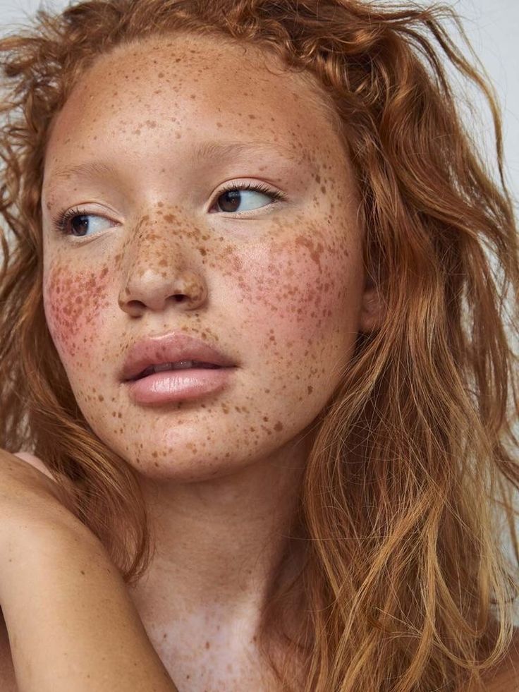 a woman with freckles on her face