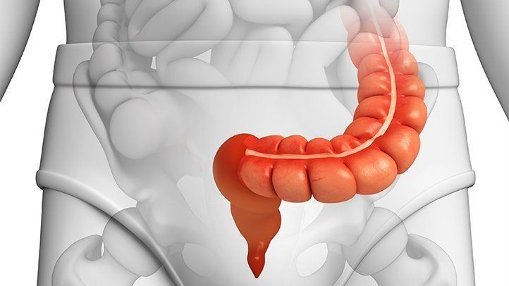 How Diverticulitis Affects the Sigmoid Colon Postnatal Massage, Sigmoid Colon, Regular Bowel Movements, A Spoonful Of Sugar, Bowel Movement, Natural Colon Cleanse, Prenatal Care, Respiratory Health, Large Intestine