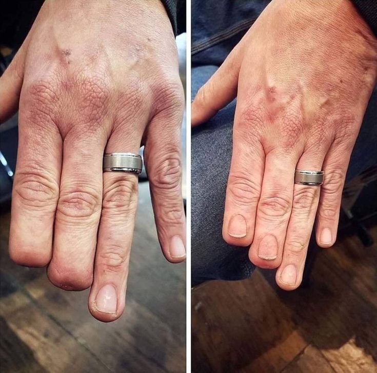 two pictures of the same person's hand with their wedding ring on it and one showing