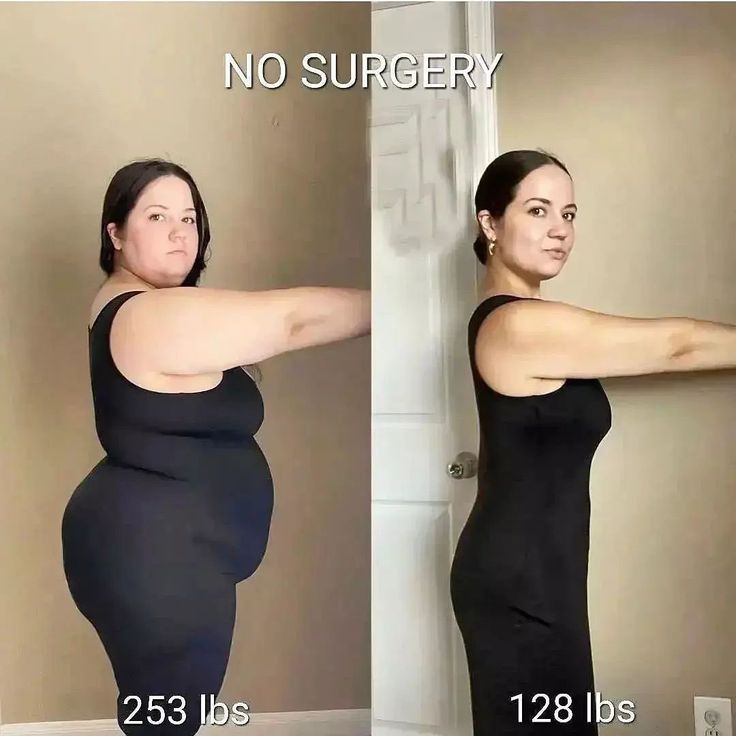 Before and after weight loss transformation. easy ways to lost weight for women | easy ways to loss belly fat fast | easy ways to loss weight for women past | easy ways to loss weight lazy girl | easy ways to lost weight in a week #lossweight #skinny #lossbellyfat howtolossweight #fitness #weightloss#weightlosstips Weights For Women, Fitness Inspiration Body, Fitness Transformation, Transformation Body, Weight Management, Healthy Weight, Belly Fat, Get Fit, Pug