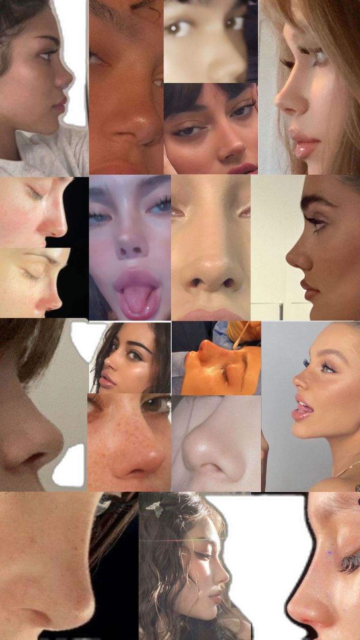 Upturned Nose, Rhinoplasty Nose Jobs, Straight Nose, Pretty Nose, Perfect Nose, Small Nose, Button Nose, Nose Shapes, Beauty Goals