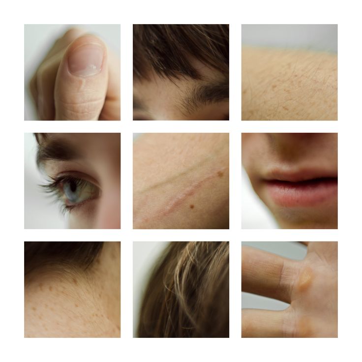 various images of different types of skin on someone's face, including the eye and nose