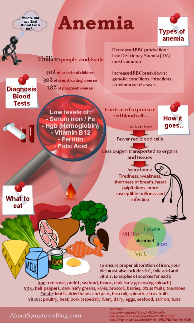 Iron Deficiency Anemia - symptoms and solutions Infographic Fat Burning Meal Plan, Foods With Iron, Iron Rich Foods, Iron Deficiency, Blood Test, Autoimmune Disease, Health Matters, Health Info, Health Remedies