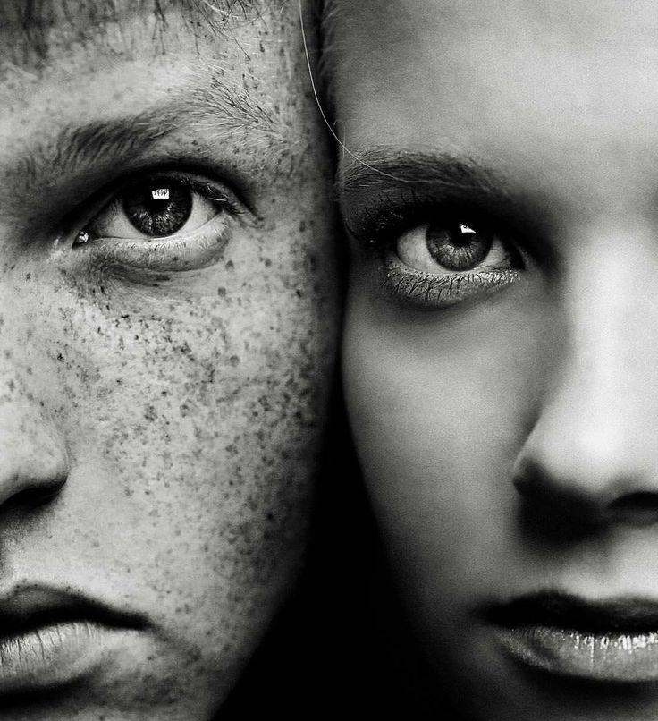 two people with freckles on their faces are looking at the camera and one person is staring