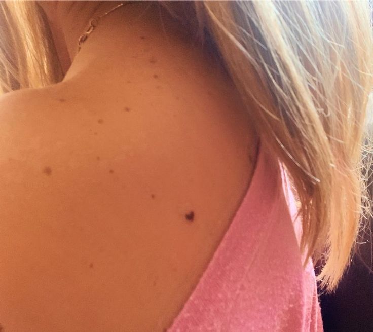 Small heart tattoo freckle dainty tattoo Heart Birthmark Aesthetic, Tattoo On Birthmark, Tattoo With Freckles, Tattoos On Birthmarks, Tiny Heart Neck Tattoo, Tiny Freckle Tattoo, Tattoos With Freckles Arms, Small Brown Heart Tattoo, Heart Beauty Mark Tattoo