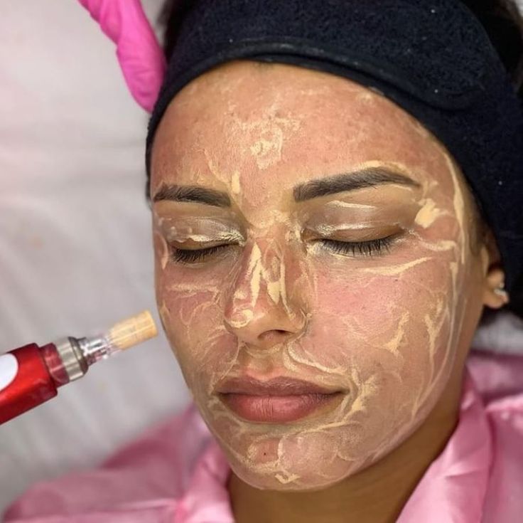 Bb Glow Facial Before And After, Bb Glow Before And After, Bb Glow Microneedling, Bb Glow Facial, Esthetician Career, Facial Before And After, Beauty Loft, Korean Facial, Bb Glow