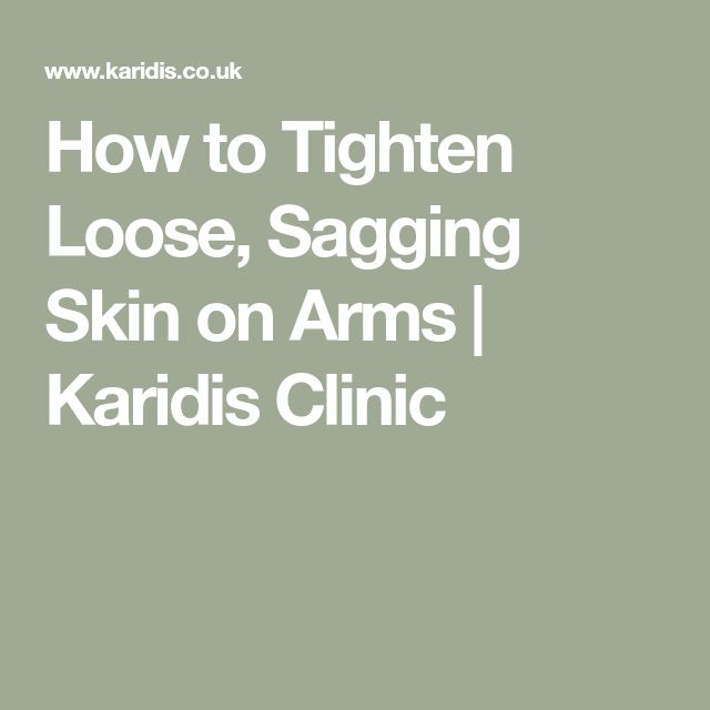 How to Tighten Loose, Sagging Skin on Arms | Karidis Clinic Arm Lift Surgery, Tone Arms, Bingo Wings, Gastric Band, Tighten Loose Skin, Body Firming, Excess Skin, Workout Chart, Wrinkled Skin