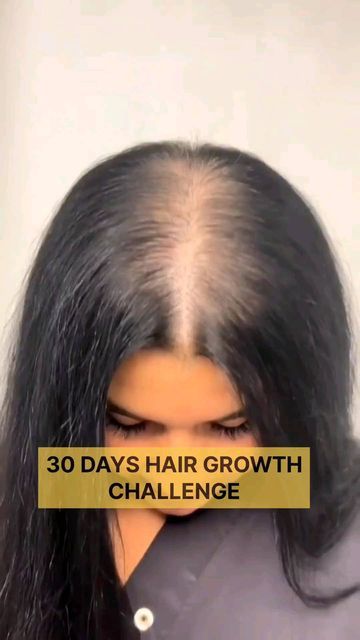 Hair Fall Remedy Home, Hair Thickening Remedies, Thicken Hair Naturally, Hair Fall Remedy, Growth Challenge, Regrow Hair Naturally, Hair Growth Challenge, Hair Fall Solution, Thick Hair Remedies