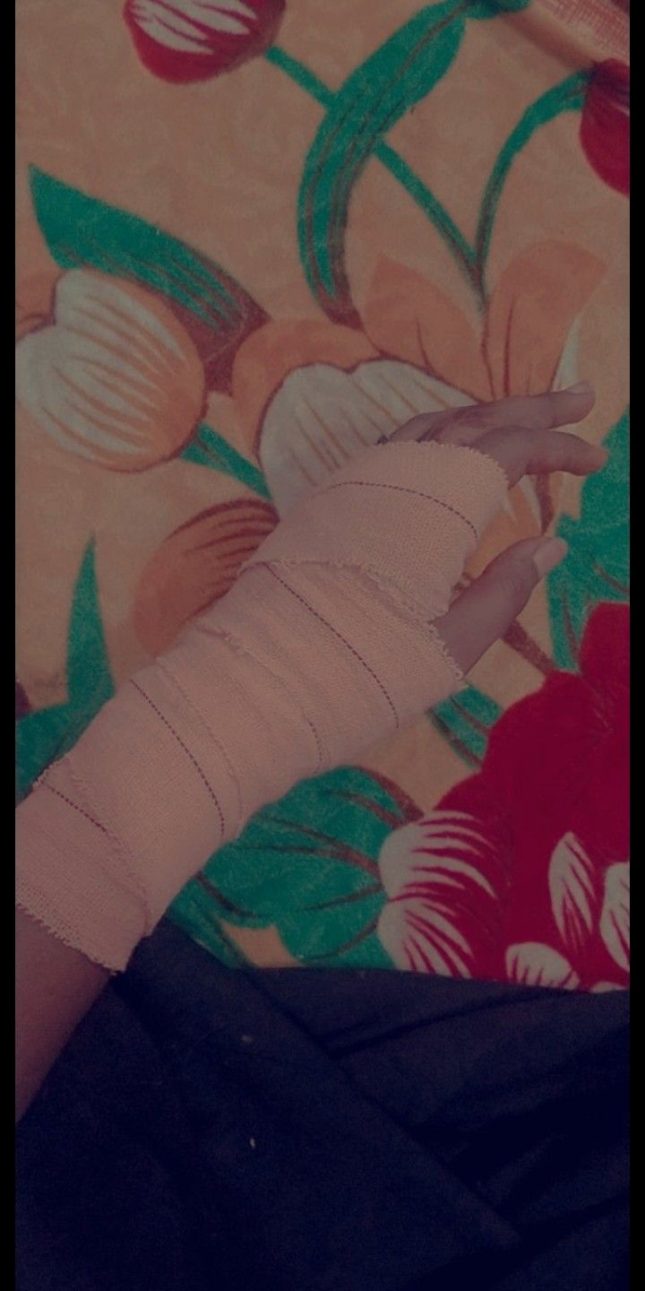 a woman's arm wrapped in bandages on top of a floral wallpaper covered floor