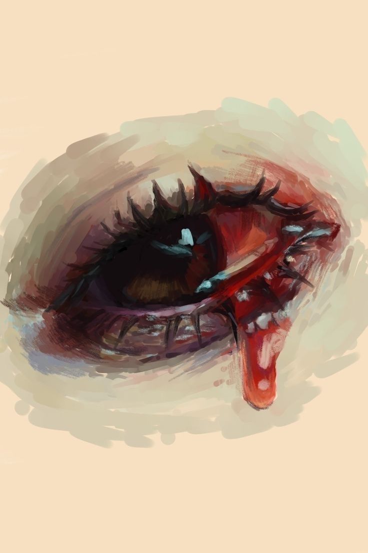 an eye with blood coming out of it