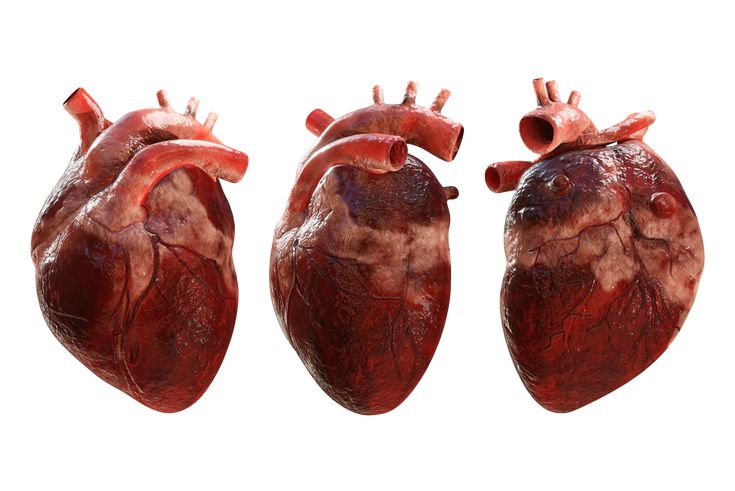 three human heart's are shown on a white background with clippings to the left and right sides