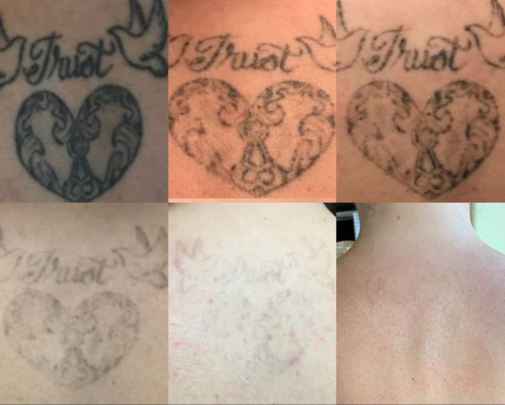 four different tattoos on the back of people's backs