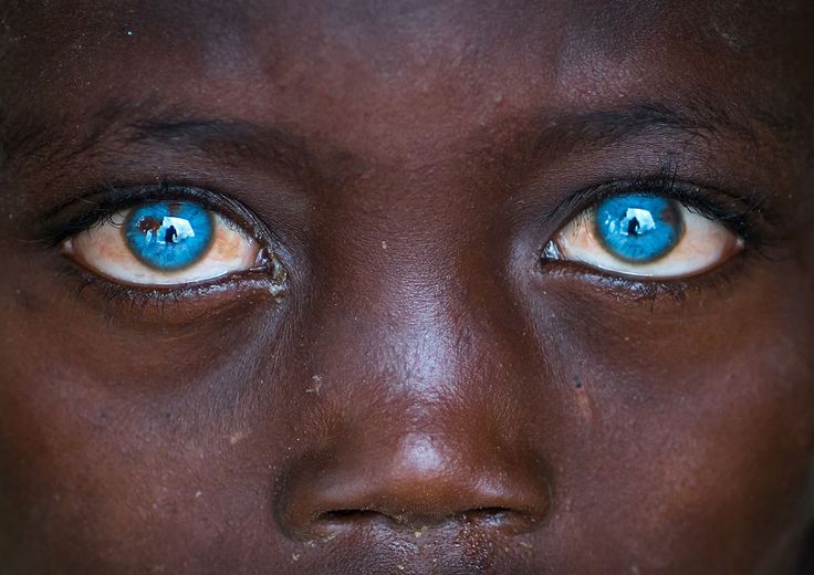 a close up of a child's face with blue eyes