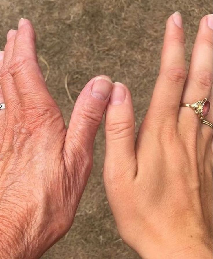 two hands with rings on their fingers, one holding the other's hand out