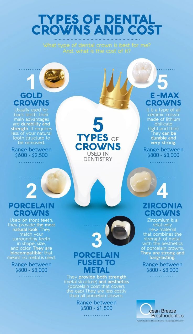 Types Of Crowns, Dental Assistant Study Guide, Dental Assistant School, Dental Hygienist School, Dental Assistant Study, Dentist Assistant, Dental Hygiene Student, Dental Posts, Kedokteran Gigi