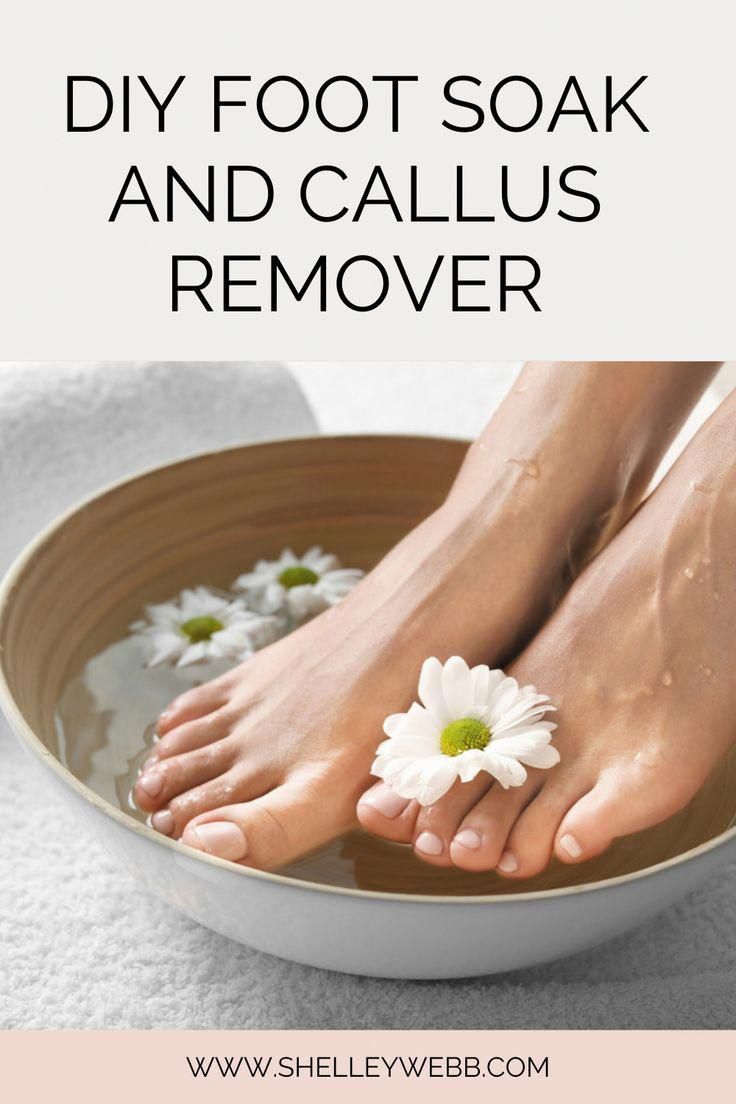 Want a homemade foot soak for smooth skin and removal of calluses that really works? Then check out this post for a DIY recipe. Foot Soak For Calluses, Callus Remover Diy, Homemade Foot Soaks, Diy Foot Soak, Callus Remover, Diy Recipe, Foot Soak, Homemade Seasonings, Pregnant Diet