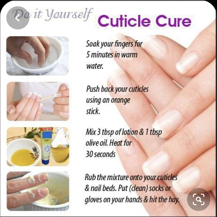 How To Get Pretty Hands, Peeling Cuticles, Around Nails, Nail Growth Tips, Nail Care Diy, Dry Cuticles, Natural Nail Care, Cuticle Care, Nagel Tips