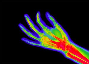 an x - ray image of a person's hand