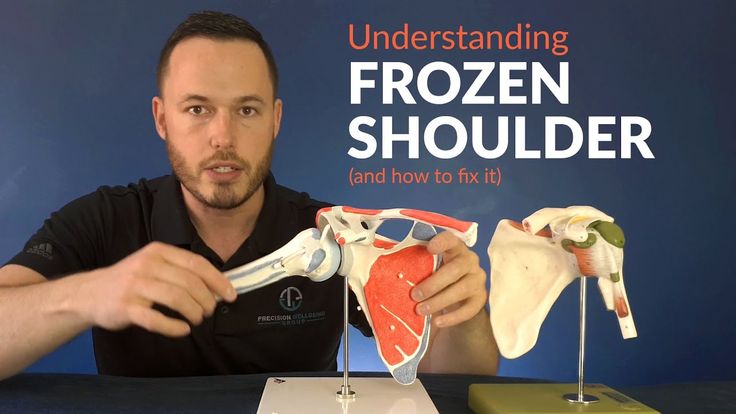 Understanding frozen shoulder and how to stretch for greater movement - YouTube Frozen Shoulder Pain, Frozen Shoulder Exercises, Rotator Cuff Exercises, Shoulder Rehab, Shoulder Stretches, Shoulder Impingement, Body Pain Relief, Shoulder Pain Relief, Frozen Shoulder