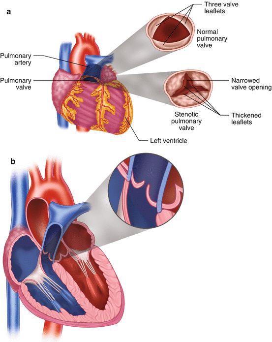 the heart is divided into two sections