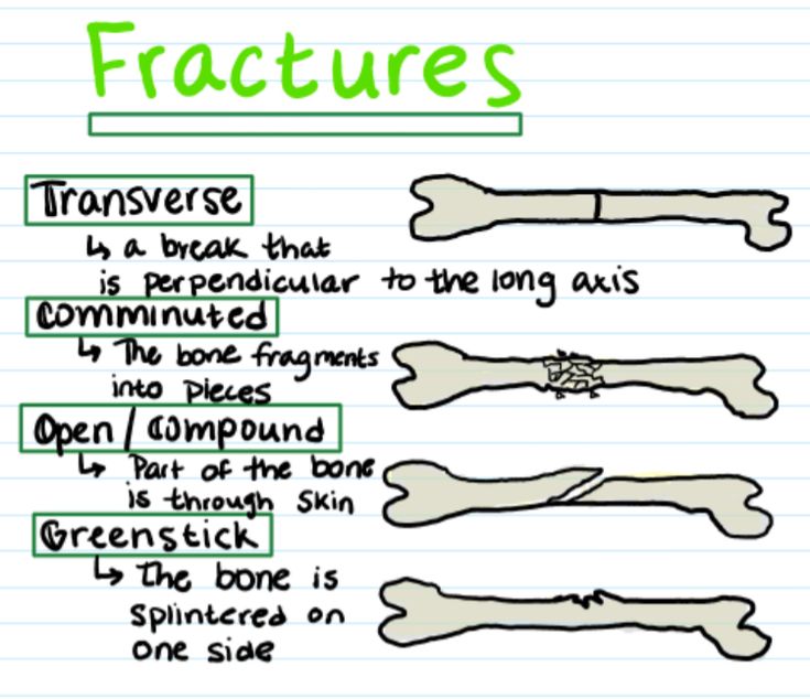 an exercise sheet with different types of dog bones and their names in green ink on lined paper