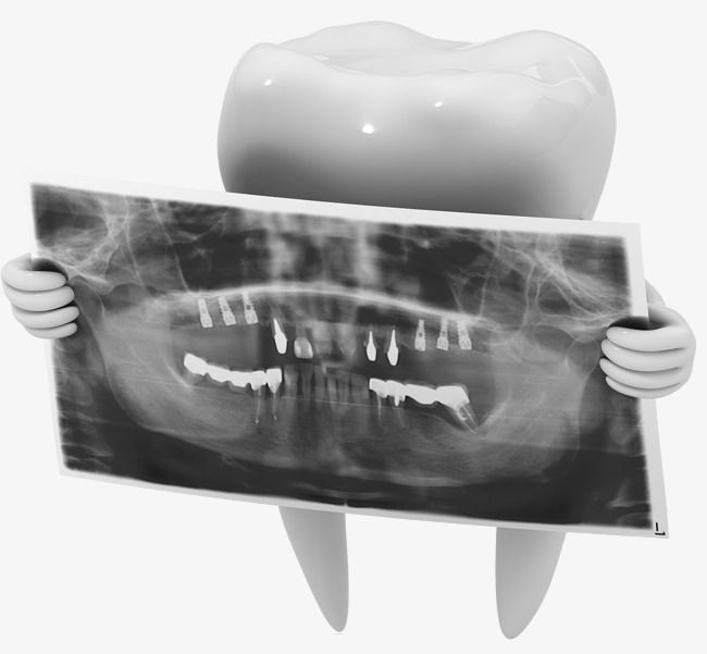 Dental Xrays, Dental Awareness, Dental X Ray, Film Png, Dentist Art, Dental Clinic Logo, Dental Advertising, Dental Studio, Ray Film