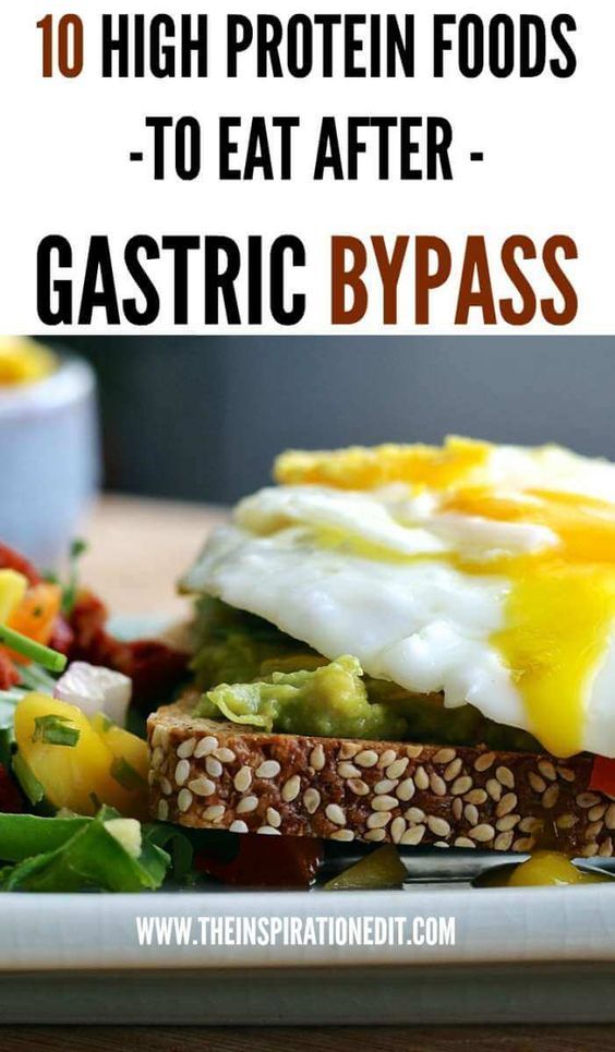 Bypass Meals, Meals Planning, Bariatric Recipes Sleeve, Gastric Bypass Diet, Bypass Recipes, Gastric Bypass Recipes, Sleeve Recipes, High Protein Foods, Bariatric Sleeve