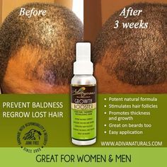 Adiva Naturals Hair Growth Booster | Fine/Balding | Great for Beards Hair Growth Tips For Men, Hair Regrowth For Men, Regrow Lost Hair, Hair Regrowth Women, Natural Hair Regrowth, Hair Growth Secrets, Rapunzel Hair, Hair Regrowth Treatments, Bathroom Gadgets