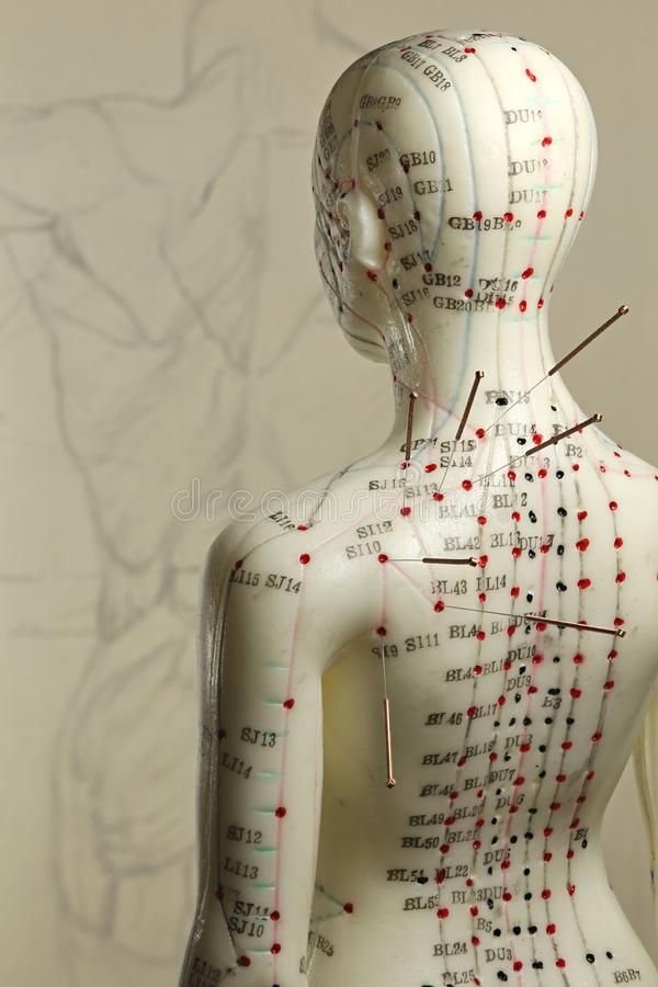 Traditional Chinese Medicine Acupuncture, Tcm Traditional Chinese Medicine, Acupuncture Point, Hurt Pain, Acupuncture Needles, Human Body Anatomy, Cupping Therapy, Acupuncture Points, Naturopathy