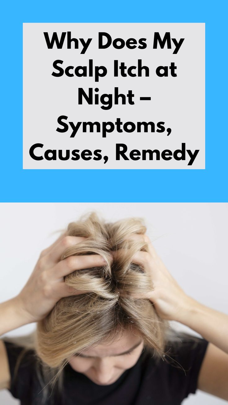 scalp itch at night Scalp Care Itchy, Head Itching Remedies, Itching Scalp Remedies Hair, Dry Itchy Scalp Remedy, Remedy For Itchy Scalp, Stop Itchy Scalp, Itchy Dry Scalp Remedy, Remedies For Itchy Scalp, Itchy Scalp Causes