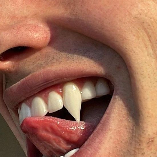 a close up of a person's mouth with teeth and gums on it