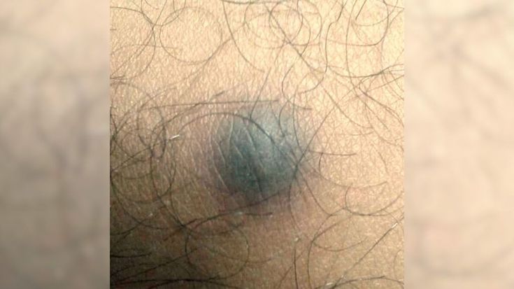 the top part of a person's stomach with hair on it