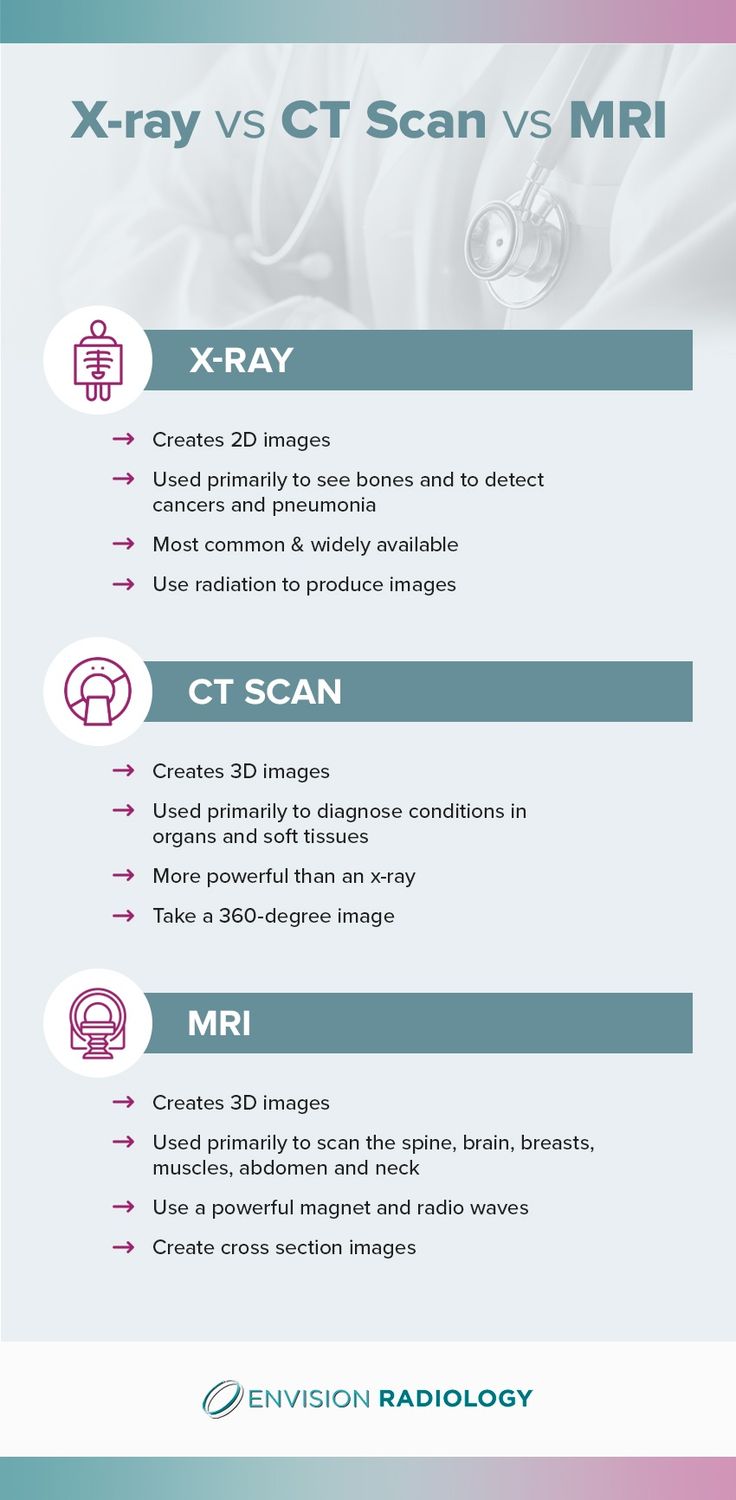 the x - ray and ct scan vs mri info sheet is shown in this image