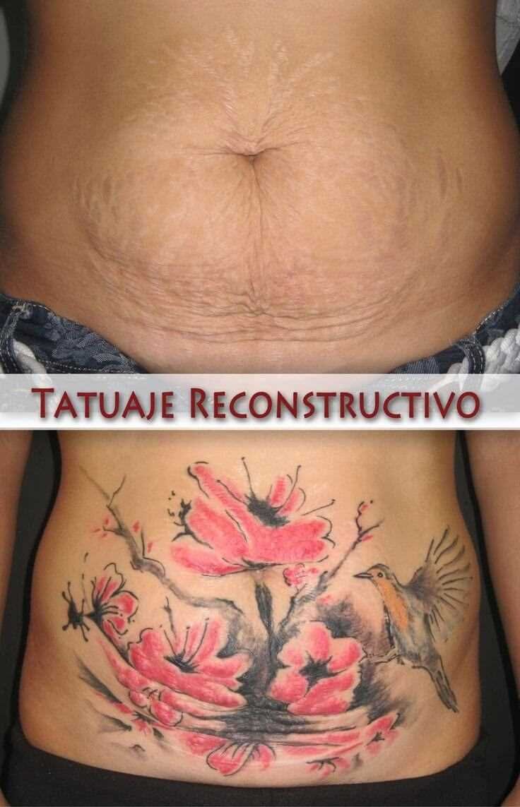 a woman's stomach with flowers and birds on the side, before and after tattoo removal