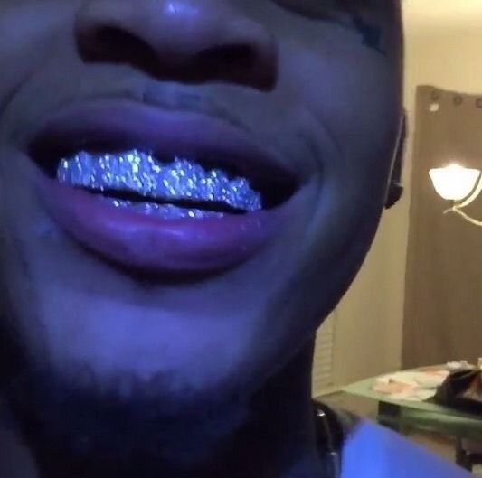 Grillz Teeth, Diamond Grillz, Gold Grillz, Boujee Aesthetic, Grills Teeth, Tooth Gem, Gold Teeth, Teeth Jewelry, Dope Jewelry