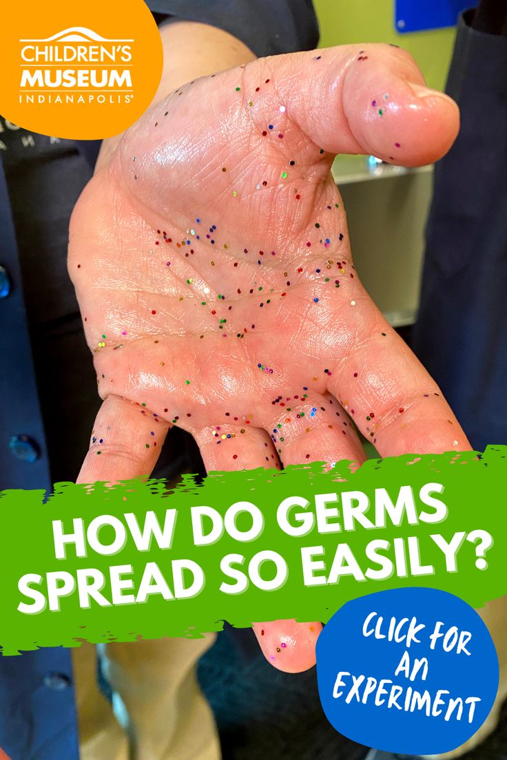 a hand with sprinkles on it that says how do germs spread so easily?