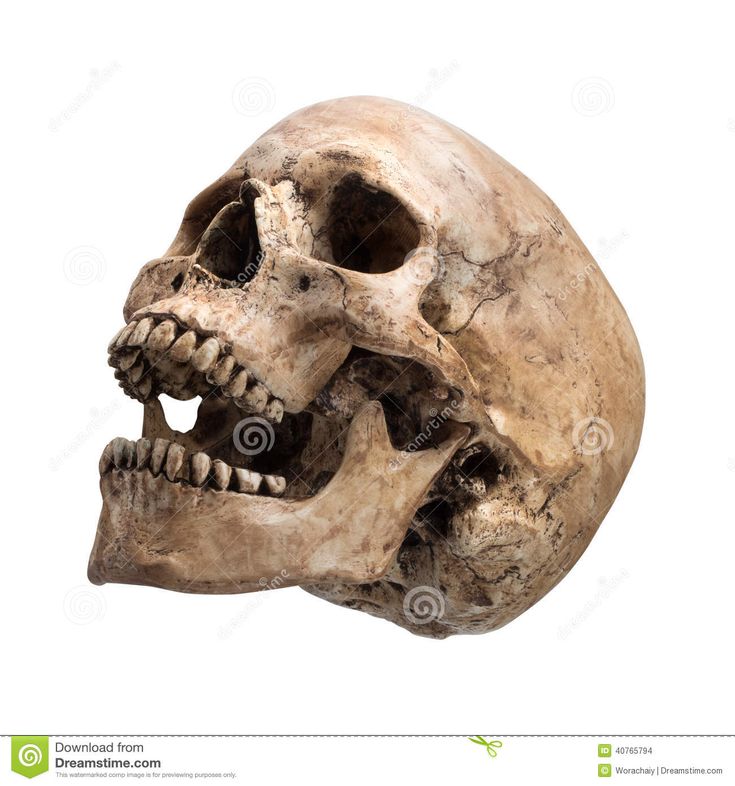 an old human skull with teeth on a white background