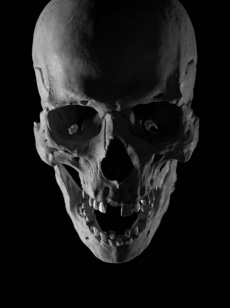 a black and white photo of a human skull