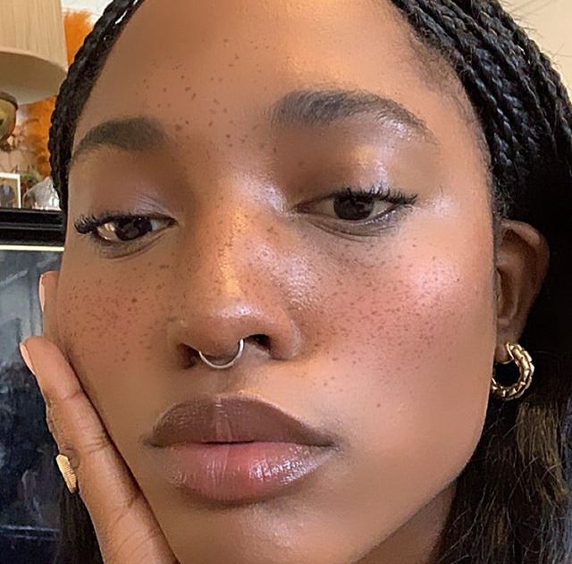 a close up of a woman with freckles on her face and hand under her chin