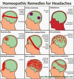 Natural homeopathic remedies for 9 types of headaches. A great alternative to modern medications - effective, natural. Sinus headache? Hangover? Migraine? Different Headaches Meaning, Life Hacks For Headaches, Homeopathic Headache Remedies, Migraine Location Meaning, Homeopathic Sinus Infection Remedies, Types Of Headaches How To Get Rid, Homeopathy For Headaches, Types Of Migraine Headaches, Homeopathy Headache Chart