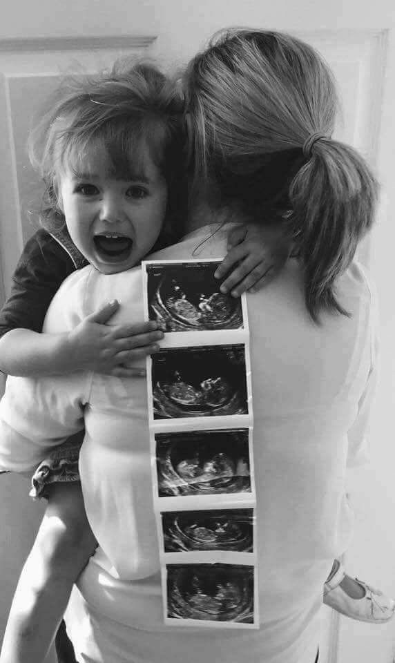 a woman holding a child in her arms with an x - ray image on it