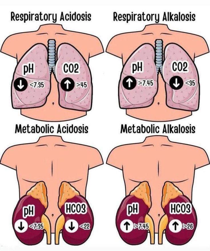 the diagram shows different stages of acidatosis and how to use it for treatment