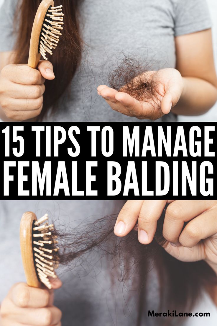 Female Balding, Natural Hair Growth Remedies, Brown Spots On Face, Home Remedies For Hair, Bald Women, Hair Control, Lost Hair, Hair Remedies, Hair Breakage