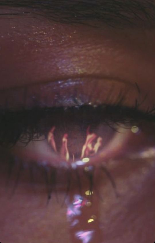 the reflection of someone's eye is seen in this image, with bright lights shining on them